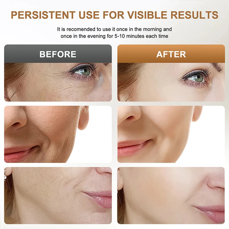 Jmk Hot Sell Huidverjonging Aanscherping Anti-Aging Face Neck Lifting Massager Led Fotontherapie Gezicht En Nek Lifting Apparaat